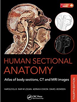 Cross sectional Anatomy.png